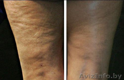 Ищу работу массажиста. - Изображение #1, Объявление #8228